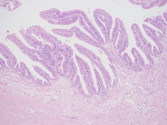 病理解剖標本を用いた研究