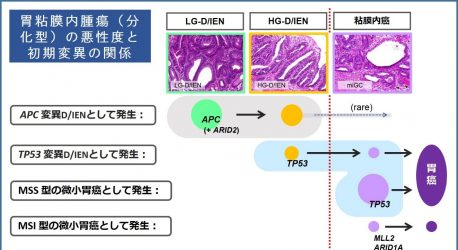 胃腫瘍の早期病変における分子遺伝学的研究